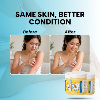 Propolis Skin Relief Balm - Intensive Repair Balm for Eczema-Prone & Psoriasis-Prone Skin