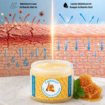 Propolis Skin Relief Balm - Intensive Repair Balm for Eczema-Prone & Psoriasis-Prone Skin