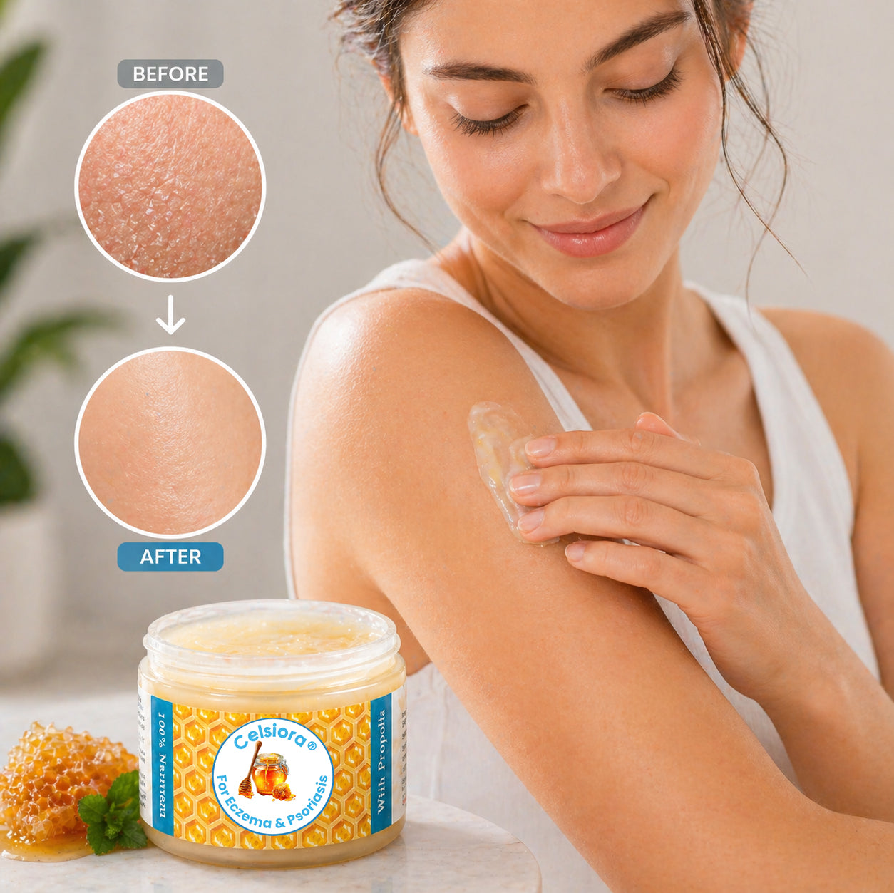 Propolis Skin Relief Balm - Intensive Repair Balm for Eczema-Prone & Psoriasis-Prone Skin