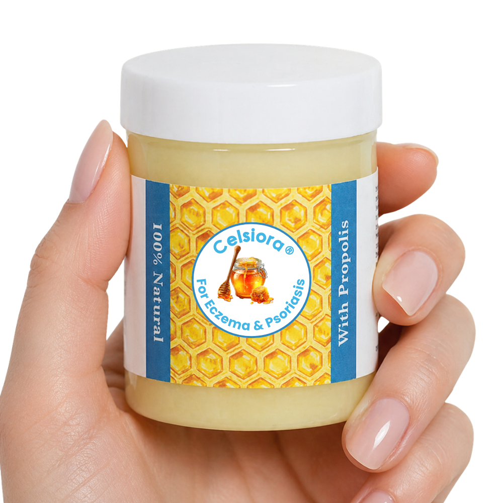 Propolis Skin Relief Balm - Intensive Repair Balm for Eczema-Prone & Psoriasis-Prone Skin