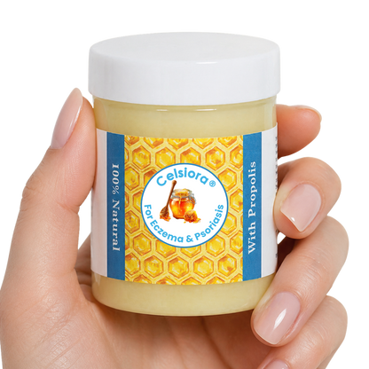 Propolis Skin Relief Balm - Intensive Repair Balm for Eczema-Prone & Psoriasis-Prone Skin