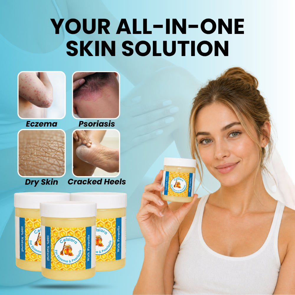 Propolis Skin Relief Balm - Intensive Repair Balm for Eczema-Prone & Psoriasis-Prone Skin