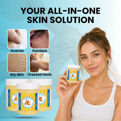 Propolis Skin Relief Balm - Intensive Repair Balm for Eczema-Prone & Psoriasis-Prone Skin